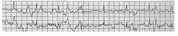 Question 9 EKG